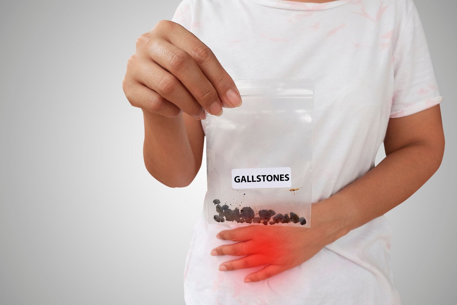 Biliary Colic(Gallstone Pain)