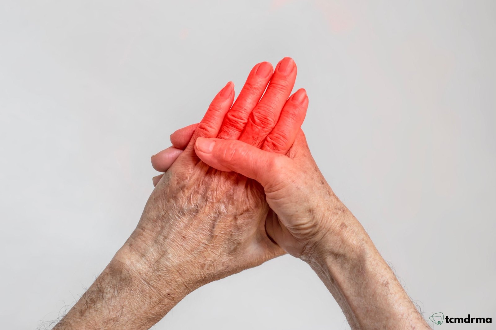 Rheumatoid Arthritis